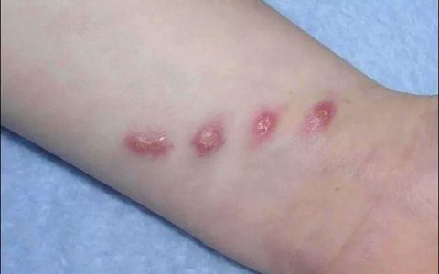 常识科普：猫爪热并不可怕